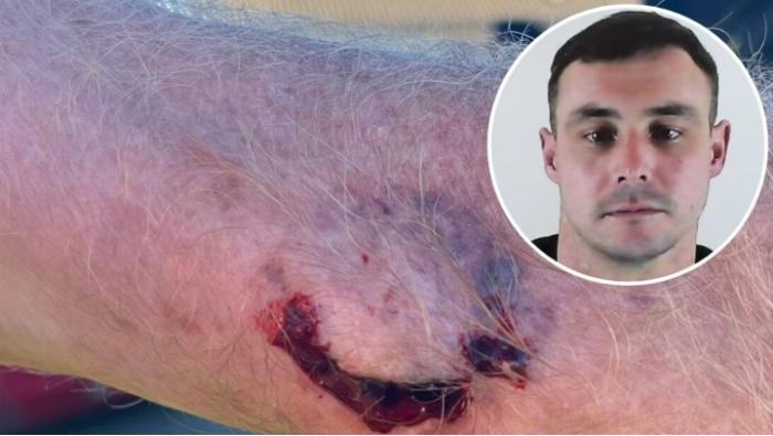 Pensioner bitten while trying to stop enraged drunk driver who just flipped car